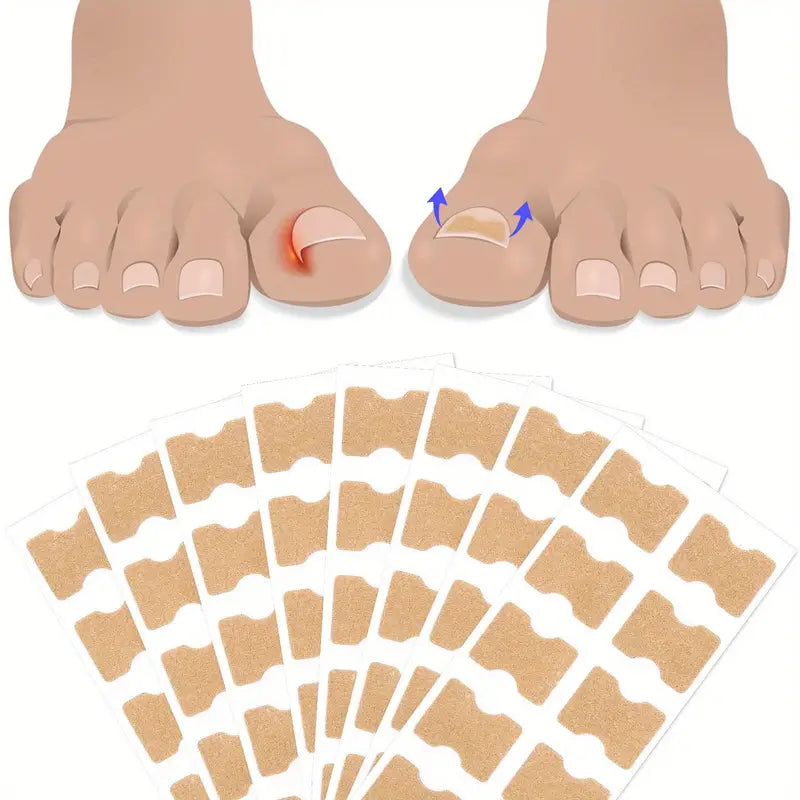 Nageltrång korrigeringstejp (50 st)
