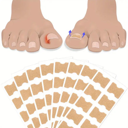 Nageltrång korrigeringstejp (50 st)