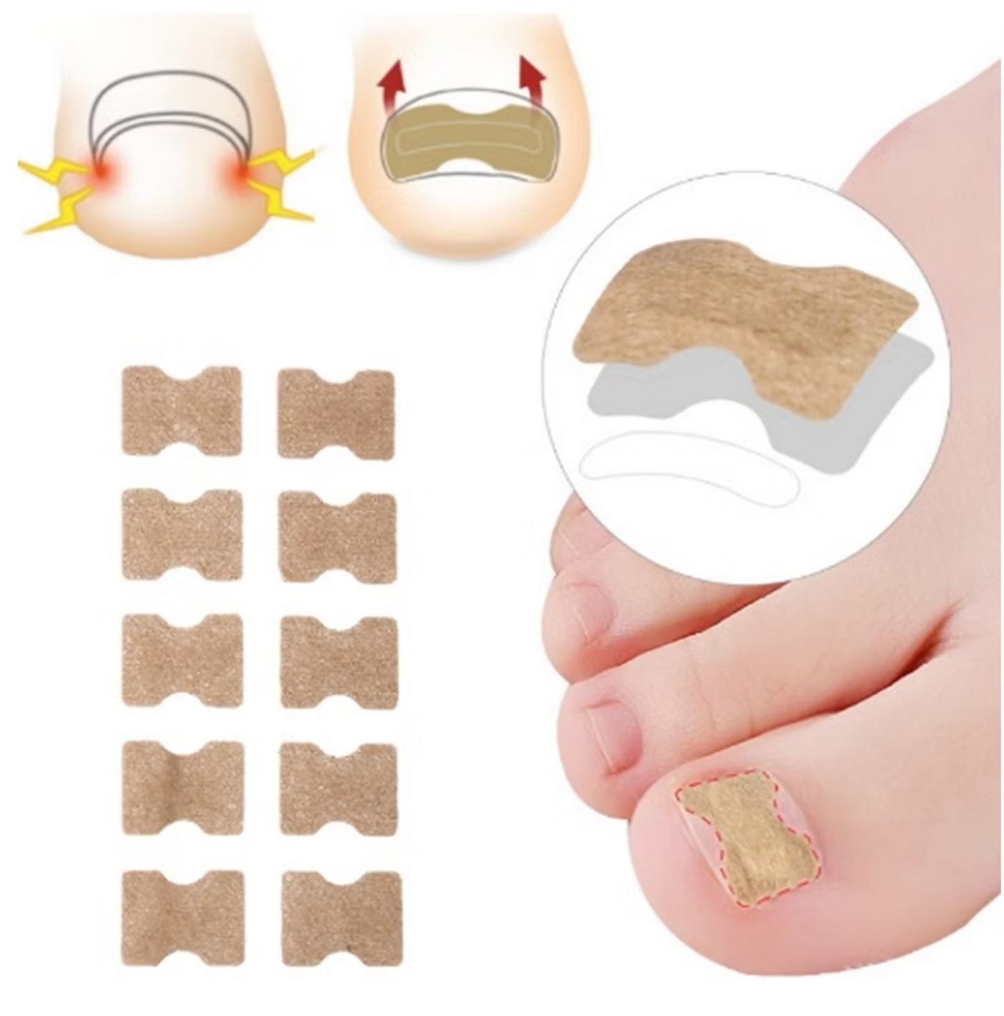 Nageltrång korrigeringstejp (50 st)