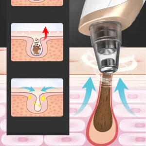 Alternative view of Elektrisk Pormaskborttagare – Uppladdningsbar Porrengörare med 3 sugnivåer